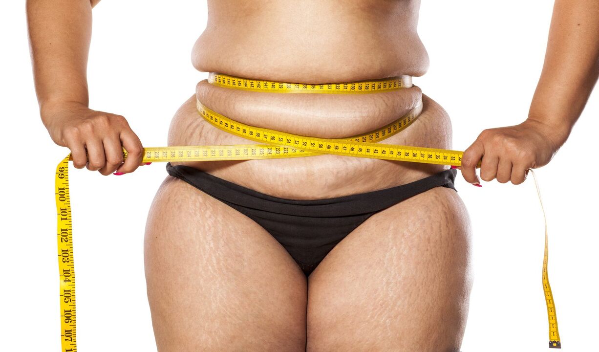 Excess weight and weight loss with zxcvbnmqwert